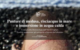 Punture di medusa, risciacquo in mare e immersione in acqua calda