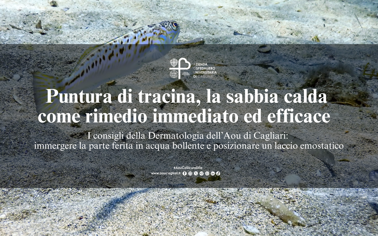 Puntura di tracina, la sabbia calda come rimedio immediato ed efficace