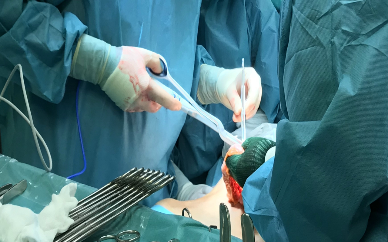 Una delle sale operatorie del Policlinico in un'immagine d'archivio