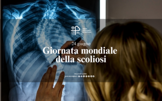 Scoliosi, fondamentale la diagnosi precoce