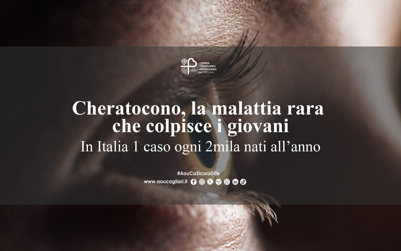 Cheratocono, la malattia rara che colpisce i giovani